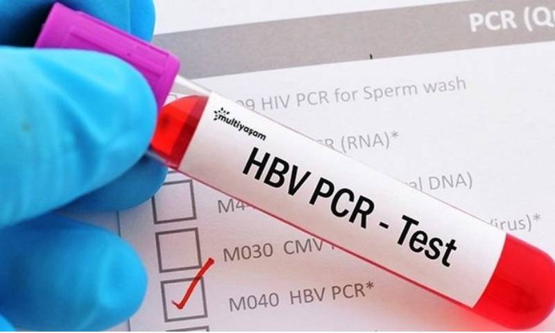 هل تقوم "مختبرات أردنية" و بالتعاون مع "مكاتب سياحية" بإرسال "PCR" عبر واتساب و دون "إجراء مسحة"؟