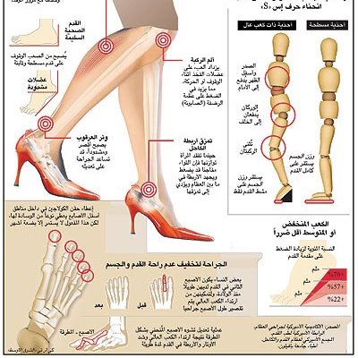 اضرار الكعب العالى 