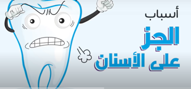 الجز "الشد" على الأسنان Bruxism  .. أسبابة ومضاعفاتتة  ..  تعرف عليها 