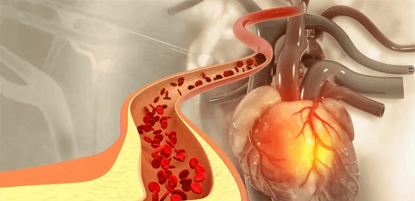 لتقليل "الكوليسترول" بشكل طبيعي ..  اتبع هذه الخطوات البسيطة
