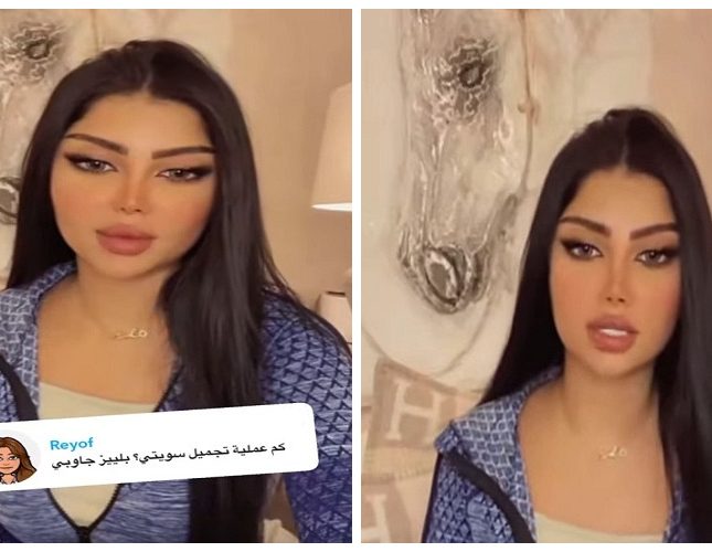 بالفيديو  ..  الفاشينيستا ملكة كابلي تخرج عن صمتها وتكشف عن تكلفة نحت جسمها