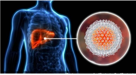  5 علامات تحذيرية قد تدل على "مشكل خطير" في الكبد 