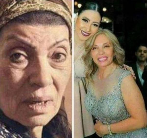 بالصور .. هل أجرت رجاء حسين عملية تجميل بعدما تجاوزت الـ80 عاماً؟ 