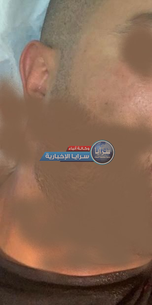 إحالة ملف قضية الاعتداء على "مستثمر" في السلط لمحكمة أمن الدولة  ..  فيديو 