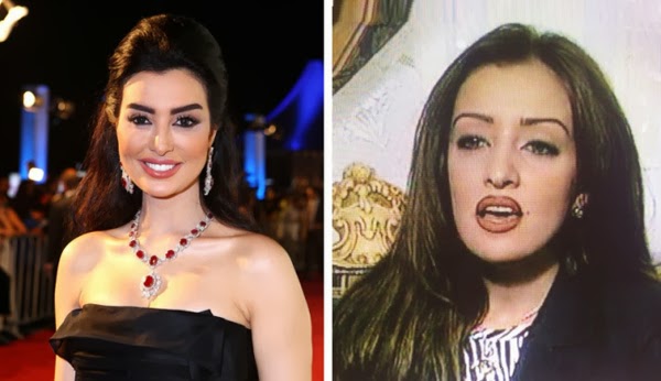 ميساء مغربي قبل وبعد عمليات التجميل  ..  كيف تغيرت ملامحها