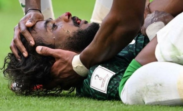 لاعب المنتخب السعودي "الشهراني" يغادر الدوحة الى الرياض لإجراء عملية جراحية