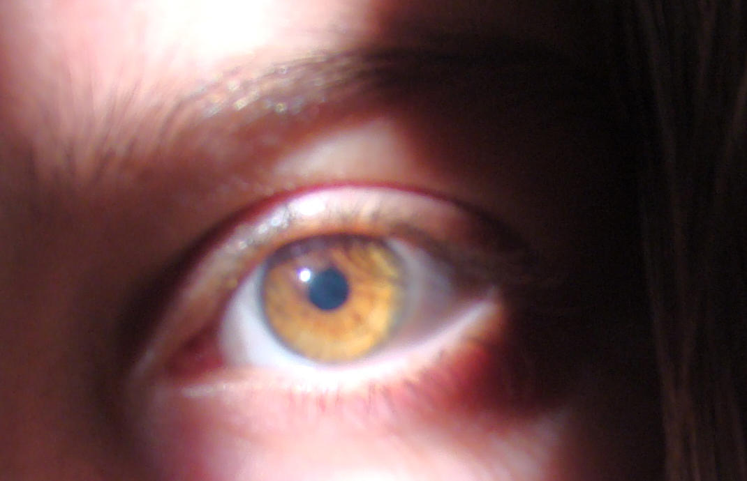 حقن التنحيف تزيد خطر الإصابة بحالة نادرة في العين