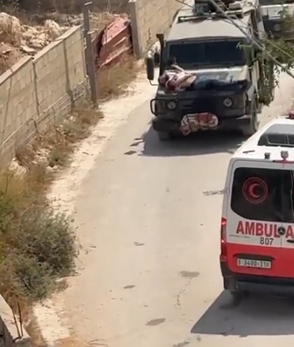 بالفيديو  ..  جيش الاحتلال يحمل جريحاً على مقدمة سيارة عسكرية ويمنع الإسعاف من الوصول إليه 