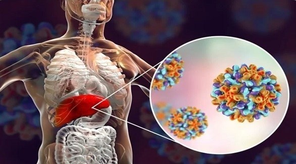 هام من المركز الوطني لمكافحة الأوبئة حول التهاب الكبد الغامض في الاردن