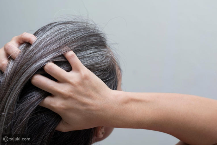 5 طرق طبيعية للتخلص من شيب الشعر